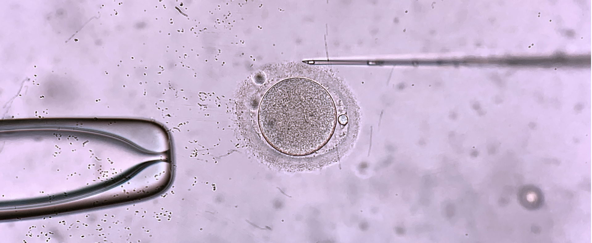 PROLIFIC_IVF2