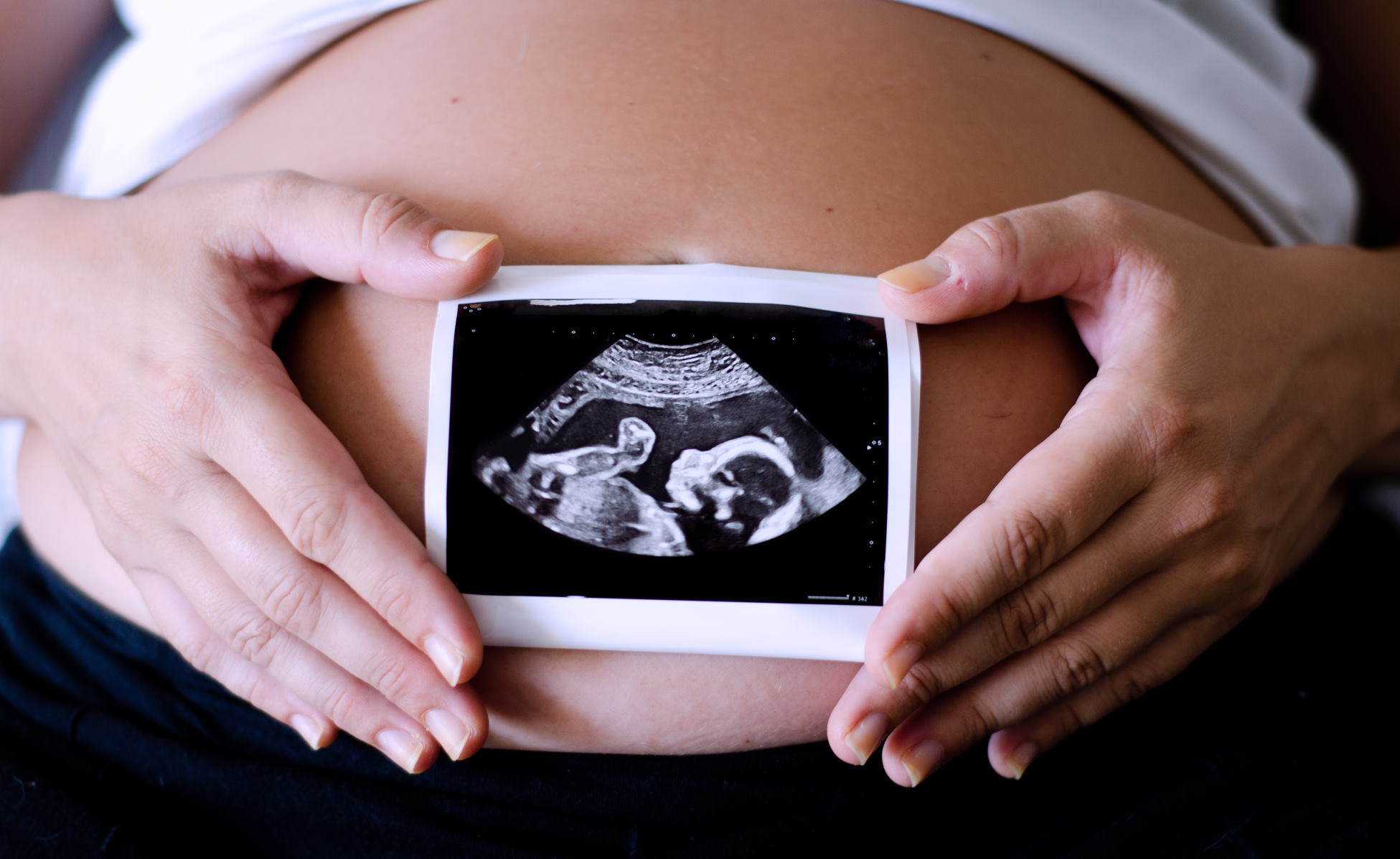 PROLIFIC_IVF5